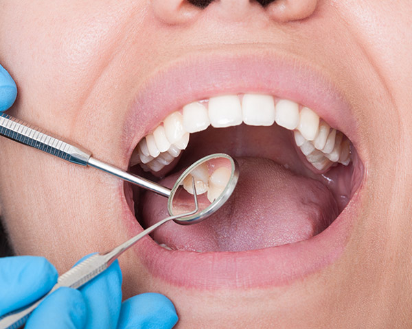 Visit Dental Dental